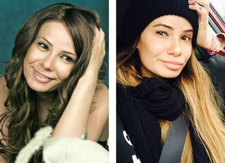 10 руски красавици преди и след скалпела