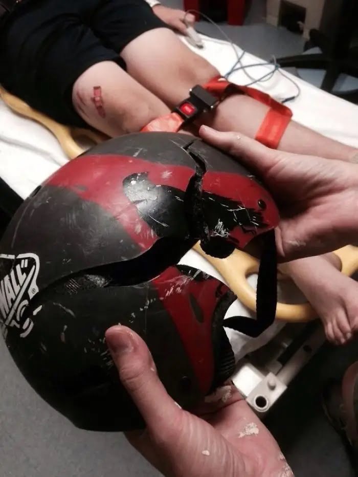 Пазете си главата: жертвите на катастрофи споделят снимки на каски, спасили живота им