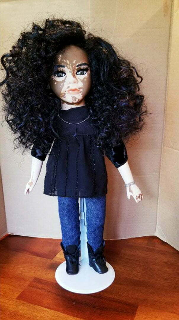 Артист създава кукли с витилиго за деца, които страдат от същото кожно заболяване