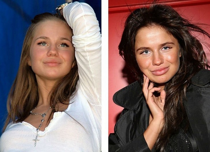 10 руски красавици преди и след скалпела