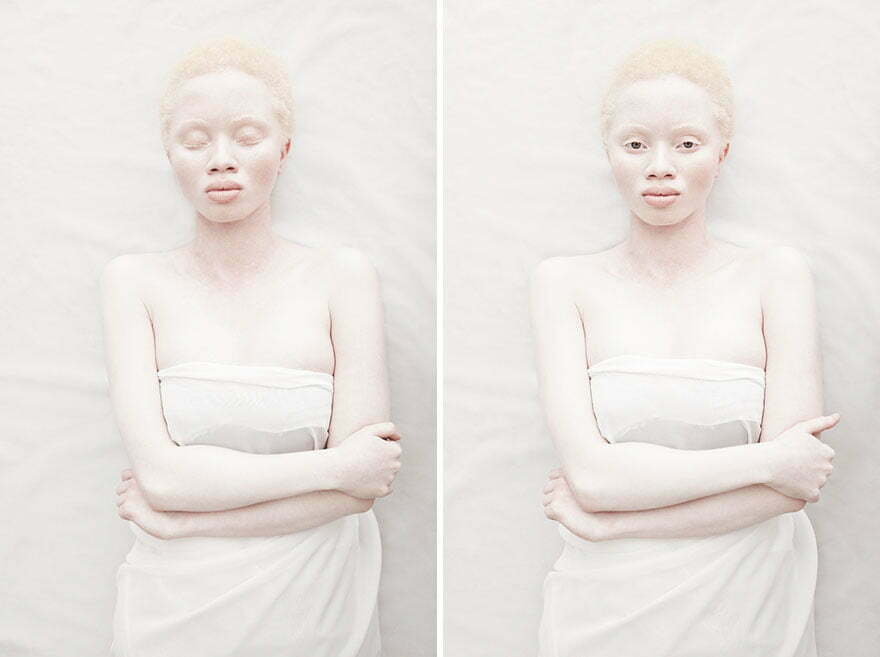 beautiful-albino-people-albinism-103-582f0093cbc45__880