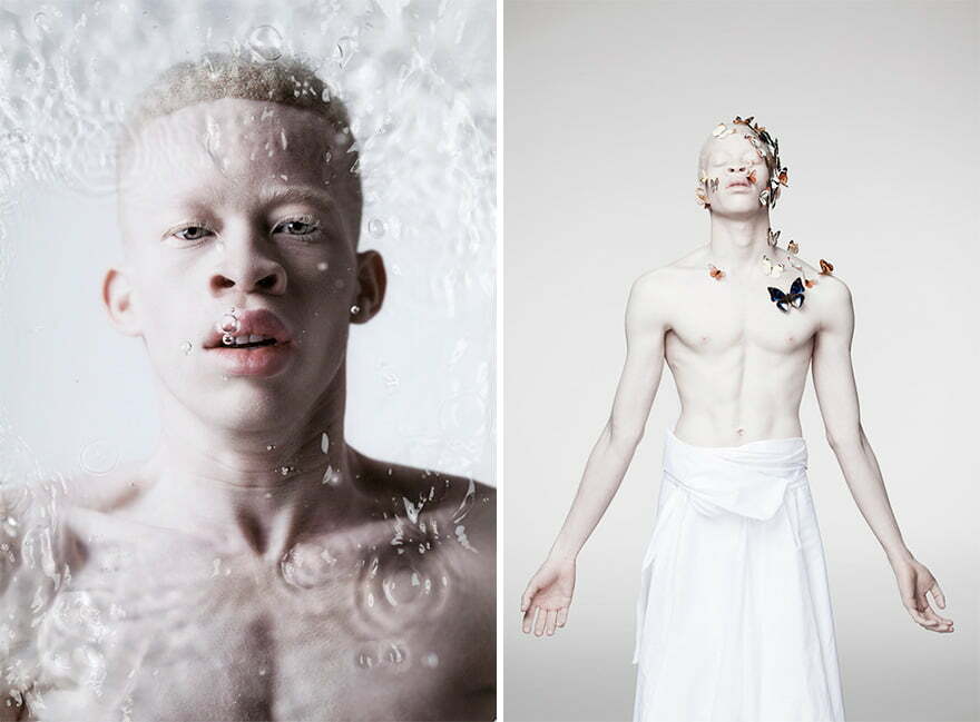 beautiful-albino-people-albinism-2-582eff9f023c1__880