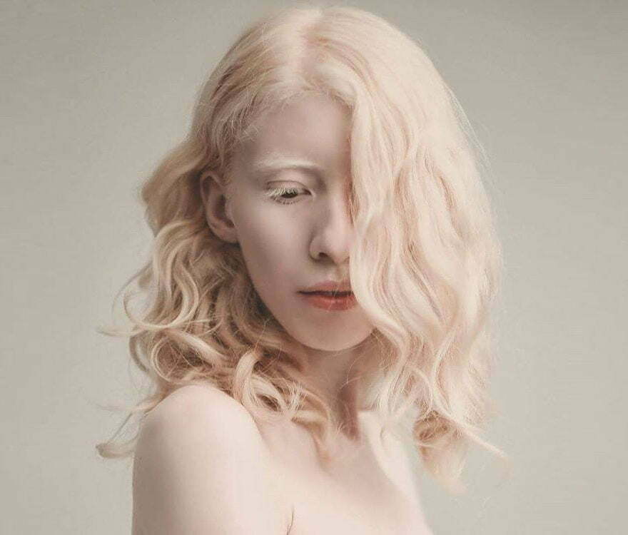 beautiful-albino-people-albinism-36-582ef52a4fc87__880