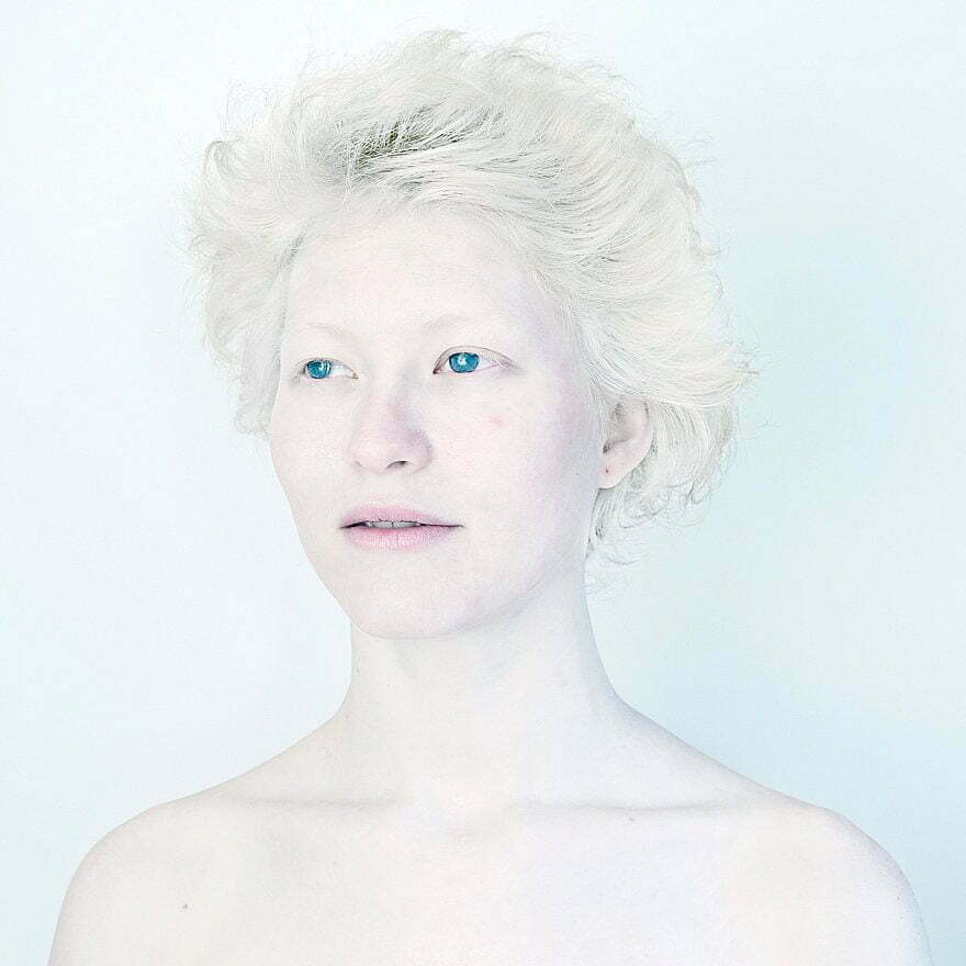 beautiful-albino-people-albinism-40-582effa20c242__880