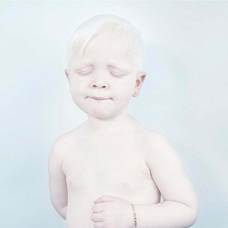 beautiful-albino-people-albinism-44-582f0461c53f7__880