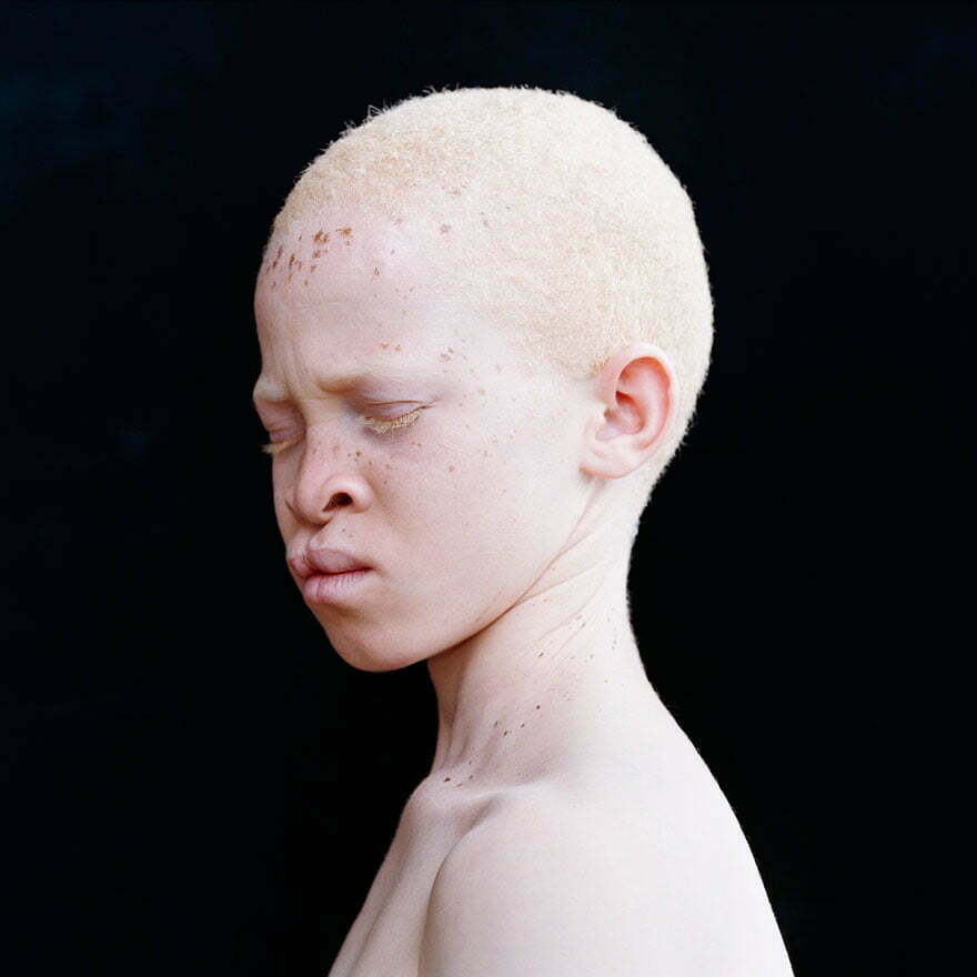 beautiful-albino-people-albinism-53-582f0302ae875__880