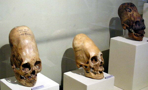 Тайната на древните хирурзи от Перу